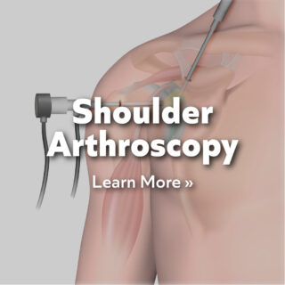 Shoulder-Arthroscopy